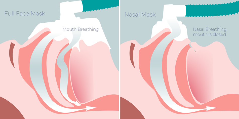 Full Face CPAP Mask and Nasla CPAP Mask